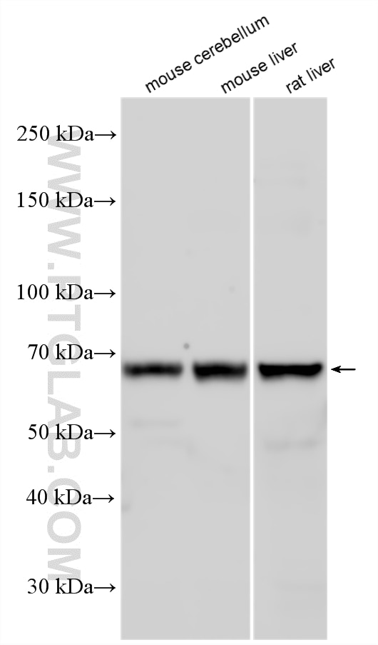 WB analysis using 24287-1-AP Western Blot (WB) analysis of various lysates using PDE11A Polyclonal antibody (24287-1-AP)