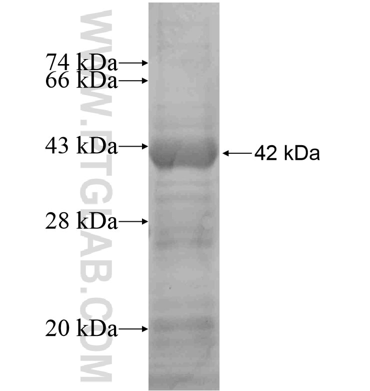 PDE11A fusion protein Ag16495 SDS-PAGE