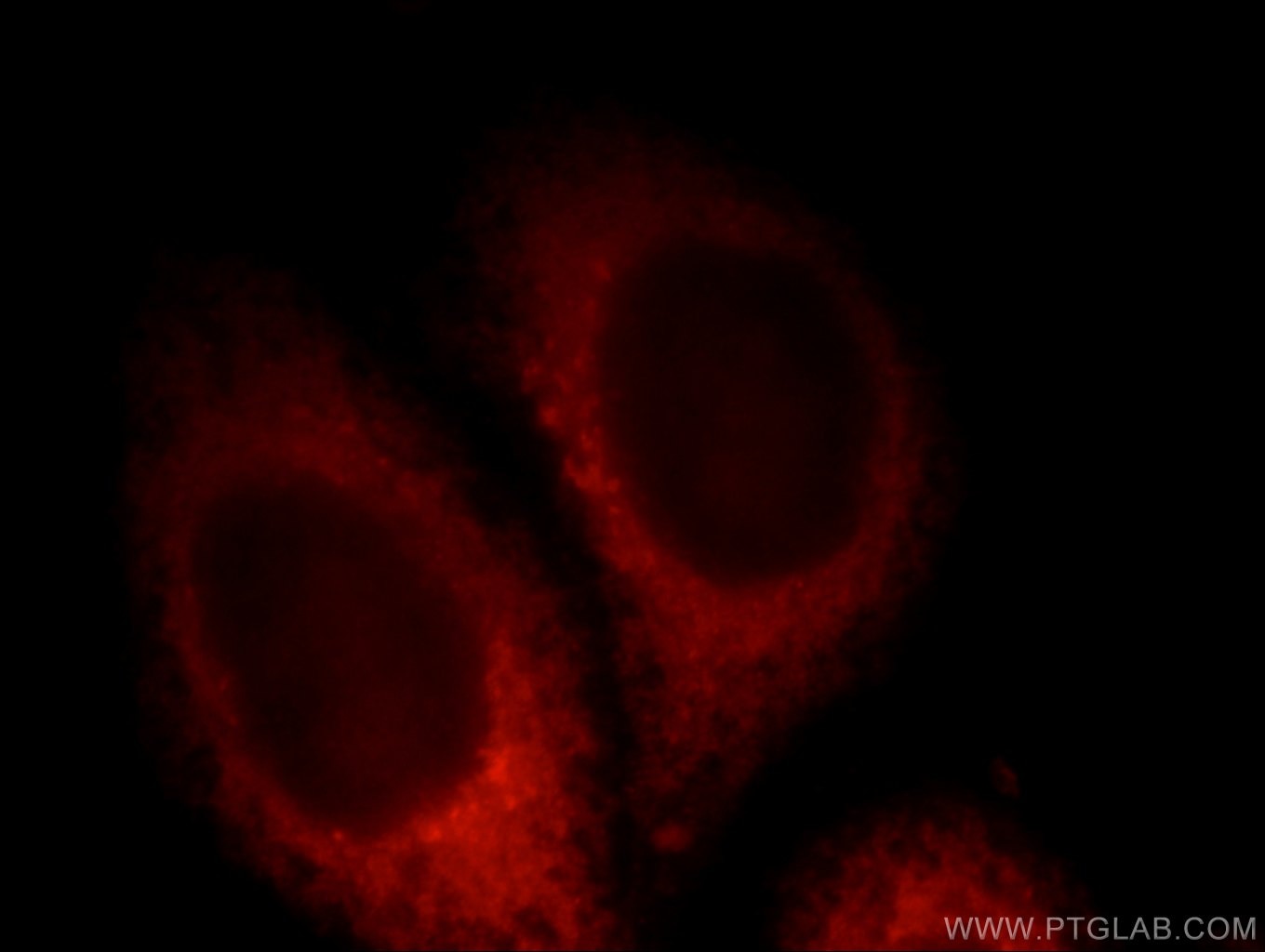 IF Staining of HepG2 using 12753-1-AP