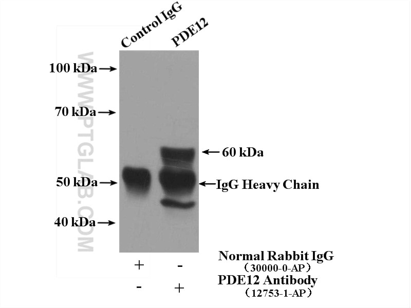 Immunoprecipitation (IP) experiment of mouse brain tissue using PDE12 Polyclonal antibody (12753-1-AP)