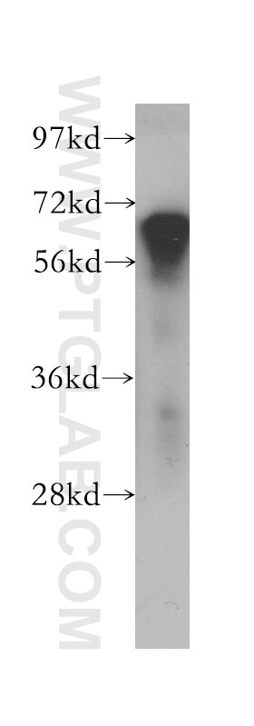 Western Blot (WB) analysis of human brain tissue using PDE12 Polyclonal antibody (12753-1-AP)