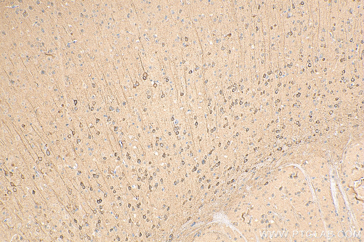 Immunohistochemistry (IHC) staining of mouse brain tissue using PDE1A Polyclonal antibody (12442-2-AP)