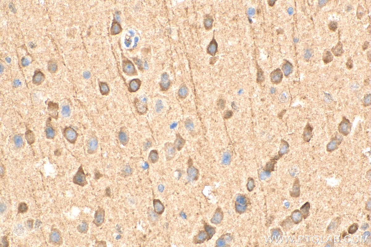 Immunohistochemistry (IHC) staining of mouse brain tissue using PDE1A Polyclonal antibody (12442-2-AP)