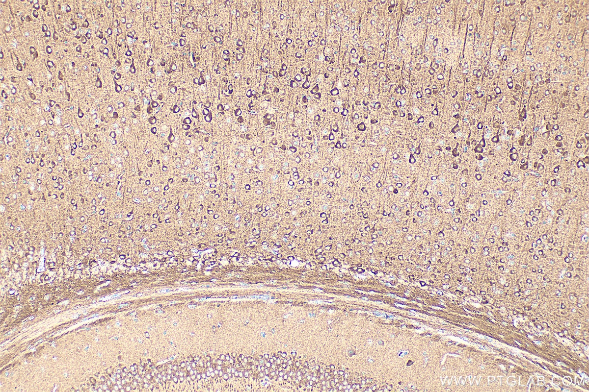 Immunohistochemistry (IHC) staining of mouse brain tissue using PDE1A Polyclonal antibody (12442-2-AP)