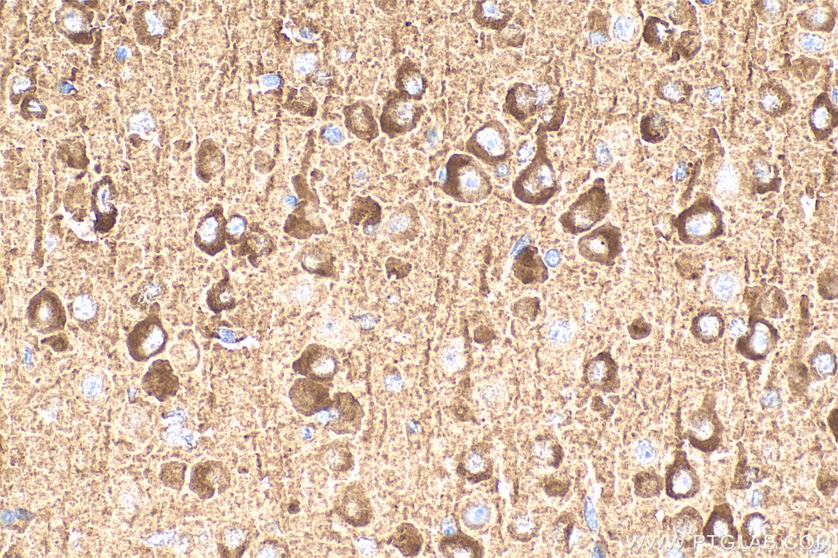 Immunohistochemistry (IHC) staining of mouse brain tissue using PDE1A Polyclonal antibody (12442-2-AP)