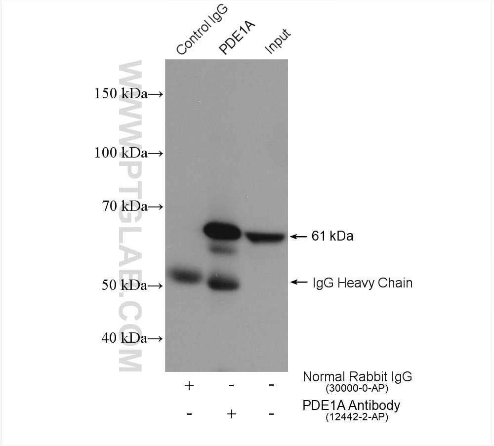 Immunoprecipitation (IP) experiment of mouse brain tissue using PDE1A Polyclonal antibody (12442-2-AP)