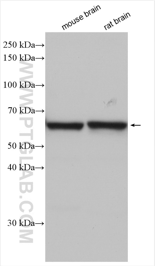 Western Blot (WB) analysis of various lysates using PDE1A Polyclonal antibody (12442-2-AP)