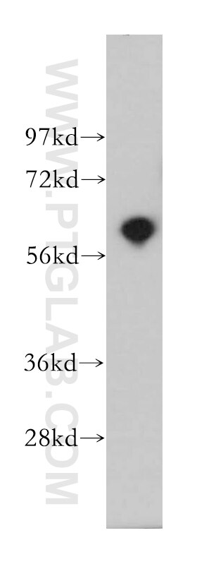 Western Blot (WB) analysis of human brain tissue using PDE1A Polyclonal antibody (12442-2-AP)