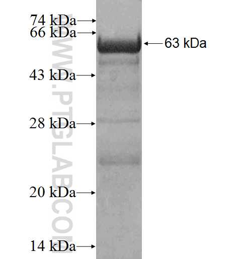 PDE1A fusion protein Ag3157 SDS-PAGE