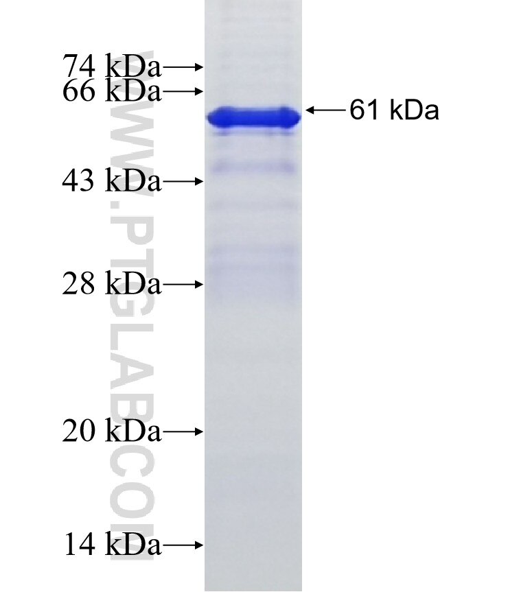 PDE1A fusion protein Ag3157 SDS-PAGE