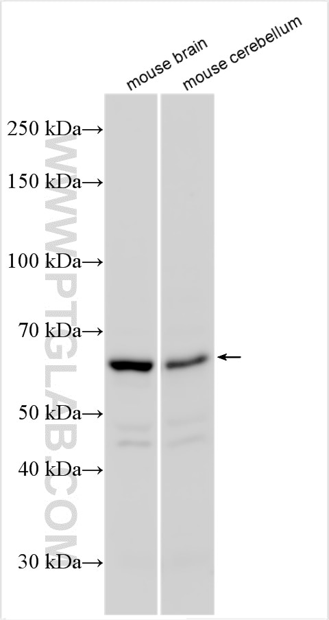 Western Blot (WB) analysis of various lysates using PDE1B Polyclonal antibody (13121-1-AP)