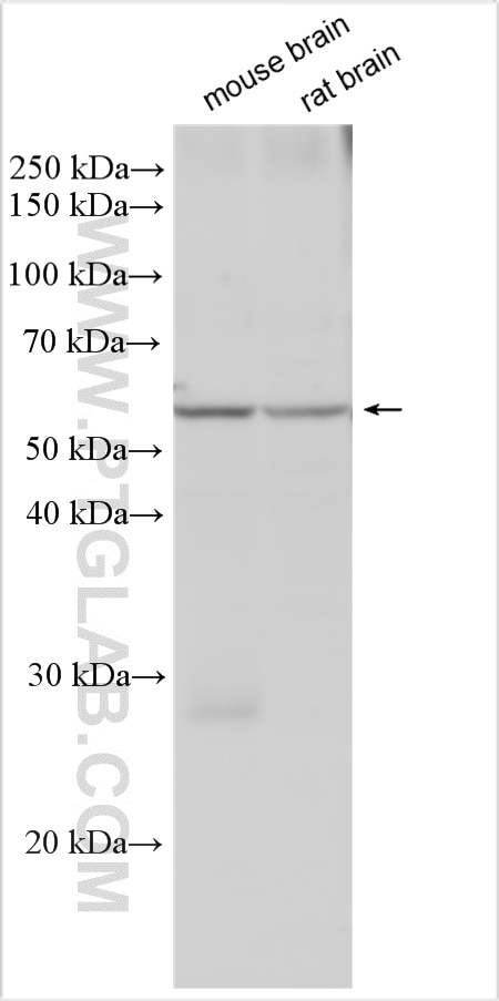 Western Blot (WB) analysis of various lysates using PDE1B Polyclonal antibody (13121-1-AP)