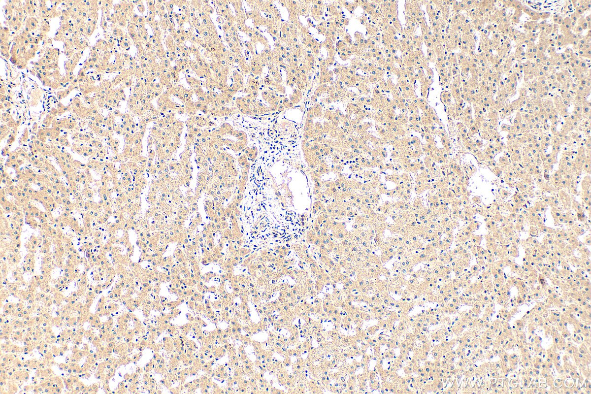Immunohistochemistry (IHC) staining of human liver tissue using PDE1C Polyclonal antibody (13785-1-AP)