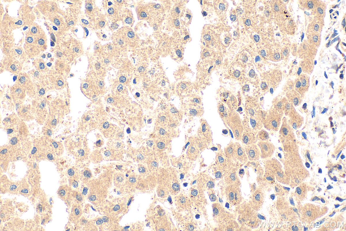 Immunohistochemistry (IHC) staining of human liver tissue using PDE1C Polyclonal antibody (13785-1-AP)