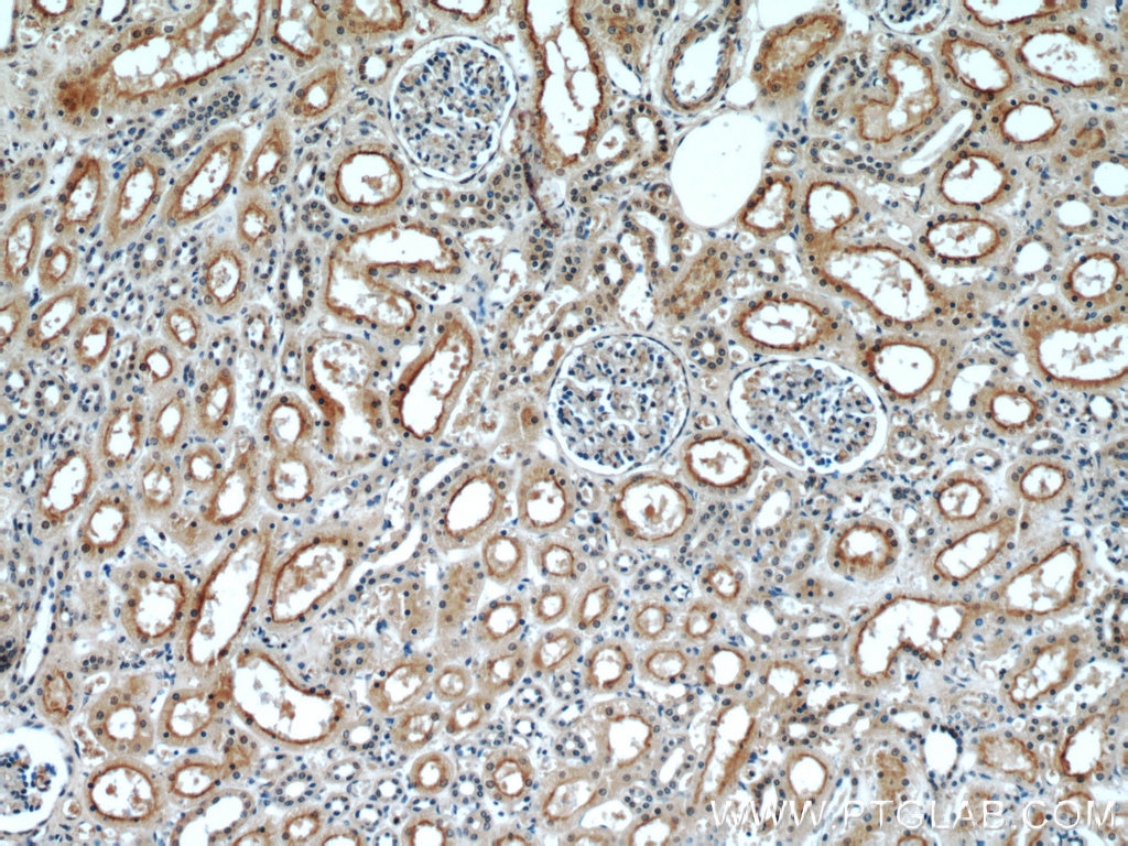 Immunohistochemistry (IHC) staining of human kidney tissue using PDE2A Polyclonal antibody (55306-1-AP)