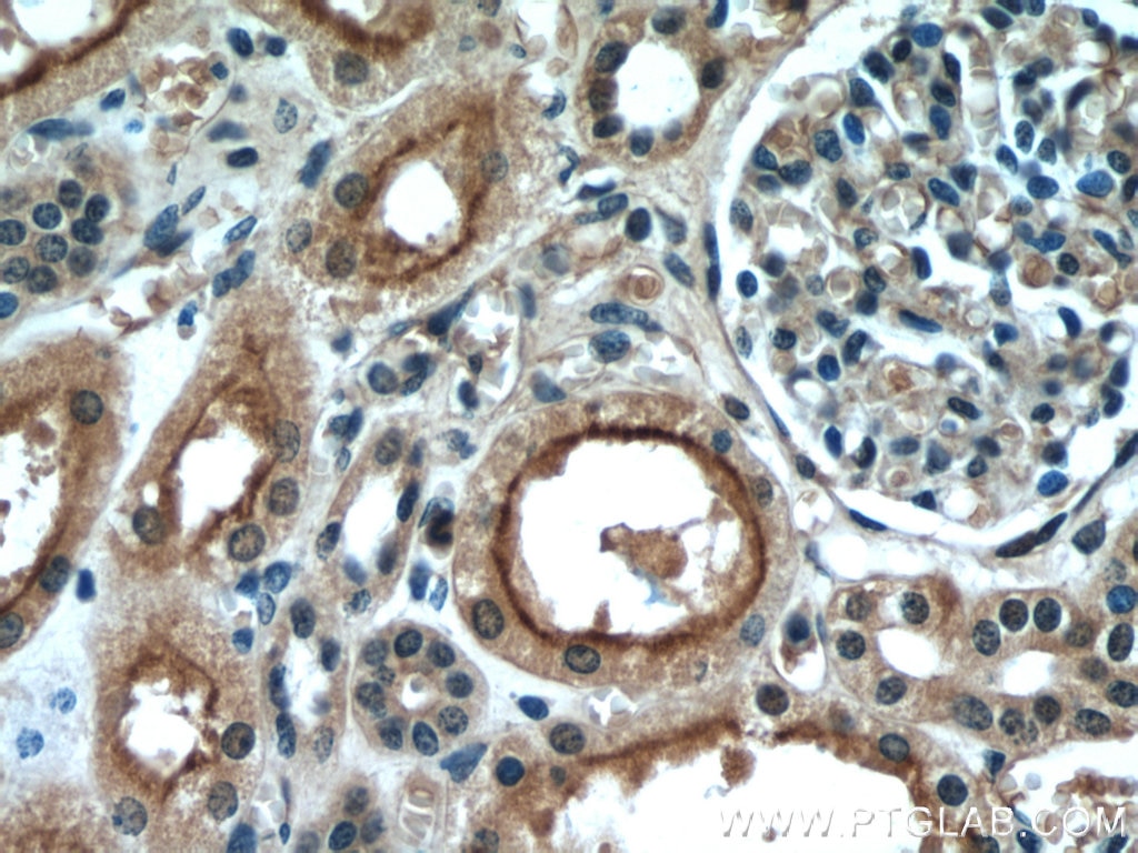 Immunohistochemistry (IHC) staining of human kidney tissue using PDE2A Polyclonal antibody (55306-1-AP)