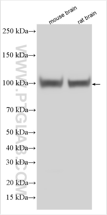 Western Blot (WB) analysis of various lysates using PDE2A Polyclonal antibody (55306-1-AP)