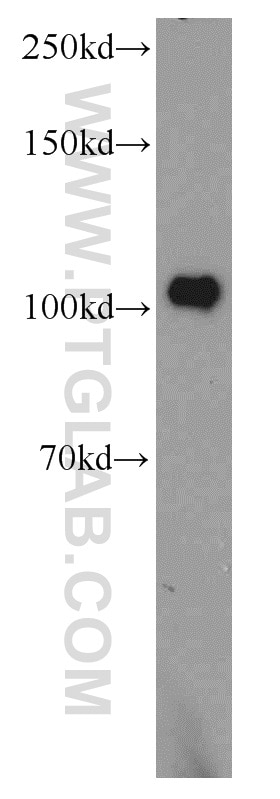 Western Blot (WB) analysis of mouse brain tissue using PDE2A Polyclonal antibody (55306-1-AP)
