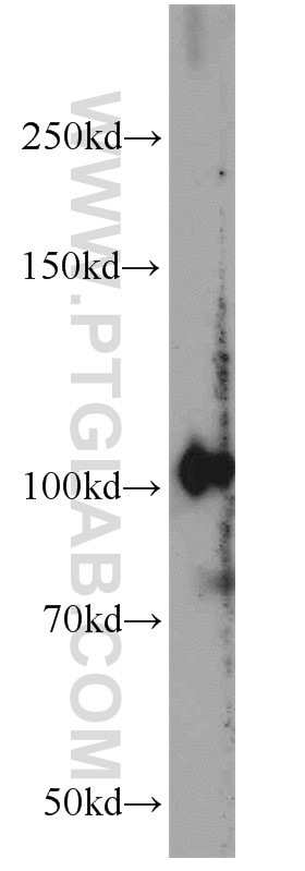 Western Blot (WB) analysis of mouse heart tissue using PDE2A Polyclonal antibody (55306-1-AP)