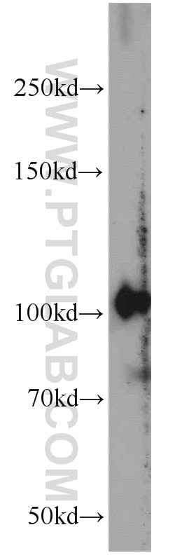 WB analysis of mouse heart using 55306-1-AP