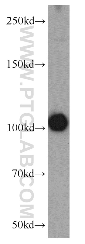 Western Blot (WB) analysis of mouse brain tissue using PDE2A Polyclonal antibody (55306-1-AP)