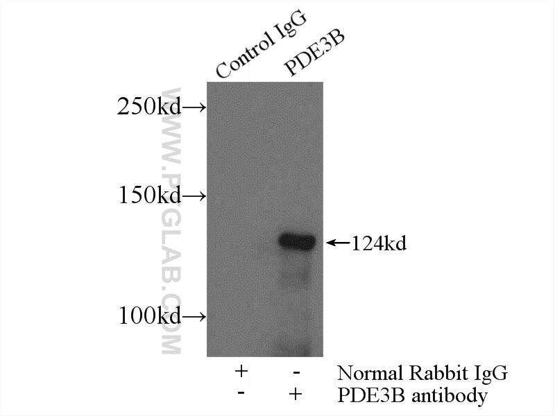 Immunoprecipitation (IP) experiment of HeLa cells using PDE3B Polyclonal antibody (25290-1-AP)