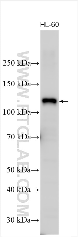 Western Blot (WB) analysis of HL-60 cells using PDE3B Polyclonal antibody (25290-1-AP)