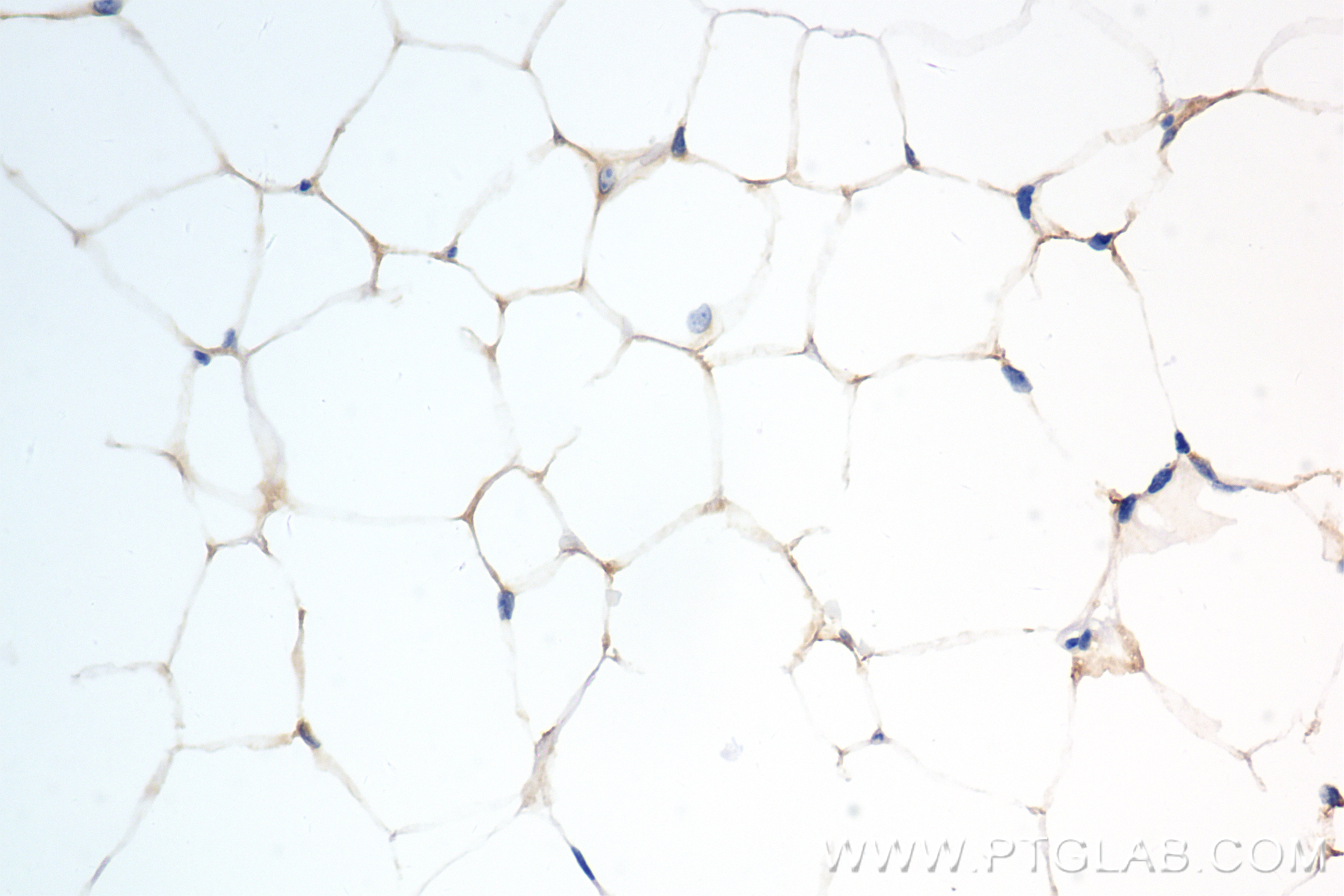 Immunohistochemistry (IHC) staining of mouse adipose tissue using PDE3B Recombinant antibody (85996-1-RR)