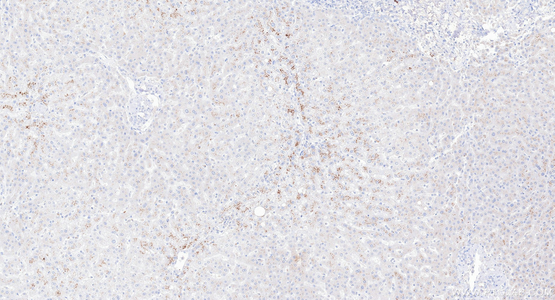 Immunohistochemistry (IHC) staining of human liver tissue using PDE3B Recombinant monoclonal antibody (85996-1-RR)