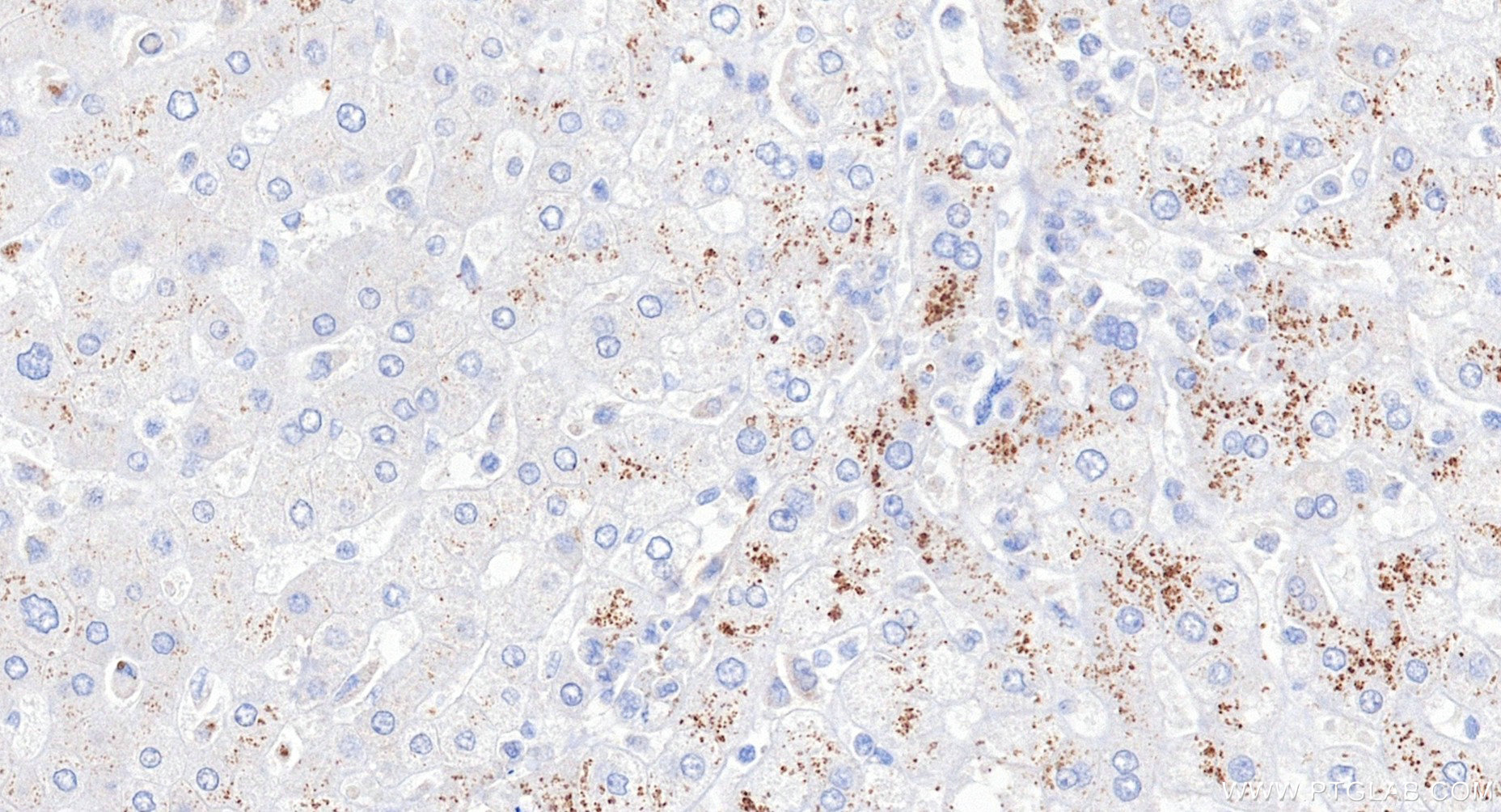 Immunohistochemistry (IHC) staining of human liver tissue using PDE3B Recombinant monoclonal antibody (85996-1-RR)
