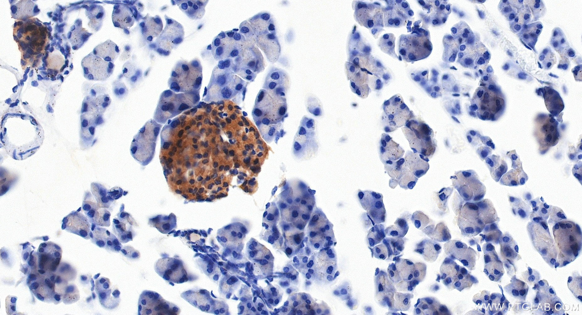 IHC staining of mouse pancreas using 85996-1-RR (same clone as 85996-1-PBS) Immunohistochemistry (IHC) staining of mouse pancreas tissue using PDE3B Recombinant monoclonal antibody (85996-1-RR)