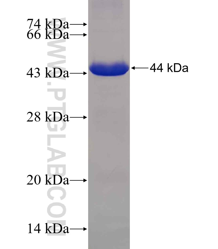 PDE3B fusion protein Ag19190 SDS-PAGE