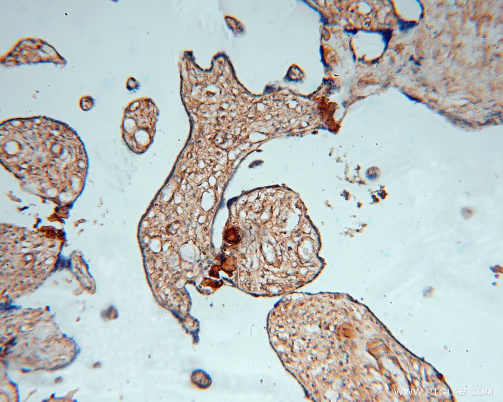 Immunohistochemistry (IHC) staining of human placenta tissue using PDE4A Polyclonal antibody (16226-1-AP)