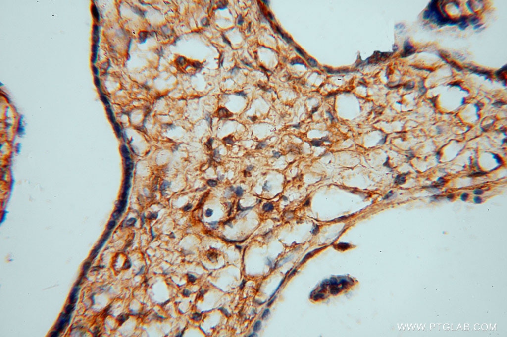 Immunohistochemistry (IHC) staining of human placenta tissue using PDE4A Polyclonal antibody (16226-1-AP)