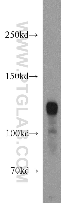 Western Blot (WB) analysis of human brain tissue using PDE4A Polyclonal antibody (16226-1-AP)