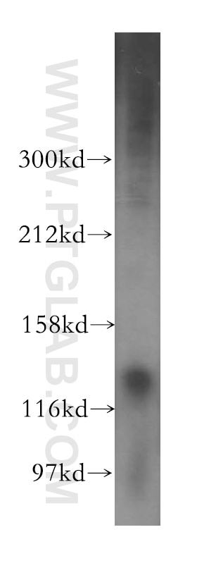 Western Blot (WB) analysis of human brain tissue using PDE4A Polyclonal antibody (16226-1-AP)