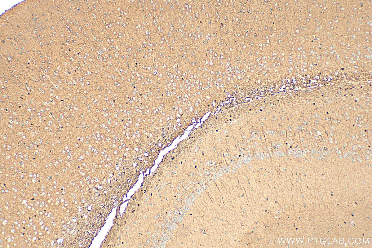 Immunohistochemistry (IHC) staining of mouse brain tissue using PDE4B Polyclonal antibody (31730-1-AP)