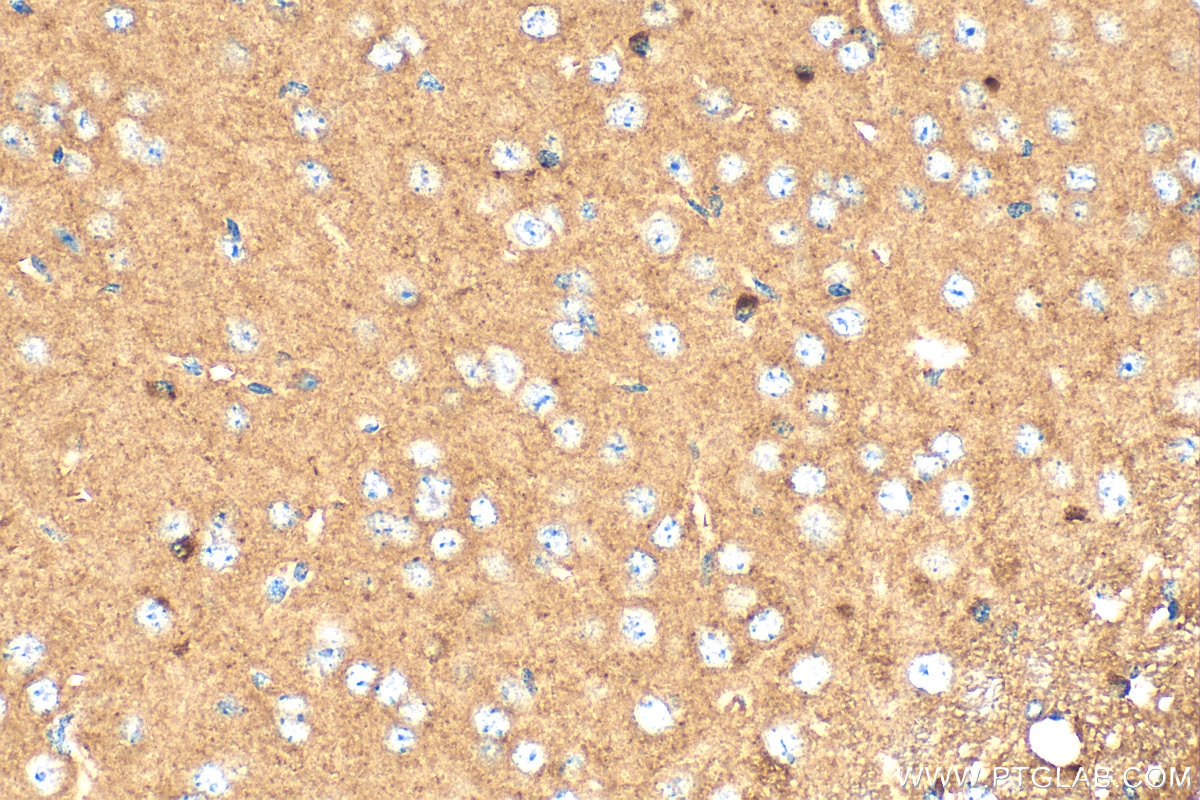 Immunohistochemistry (IHC) staining of mouse brain tissue using PDE4B Polyclonal antibody (31730-1-AP)