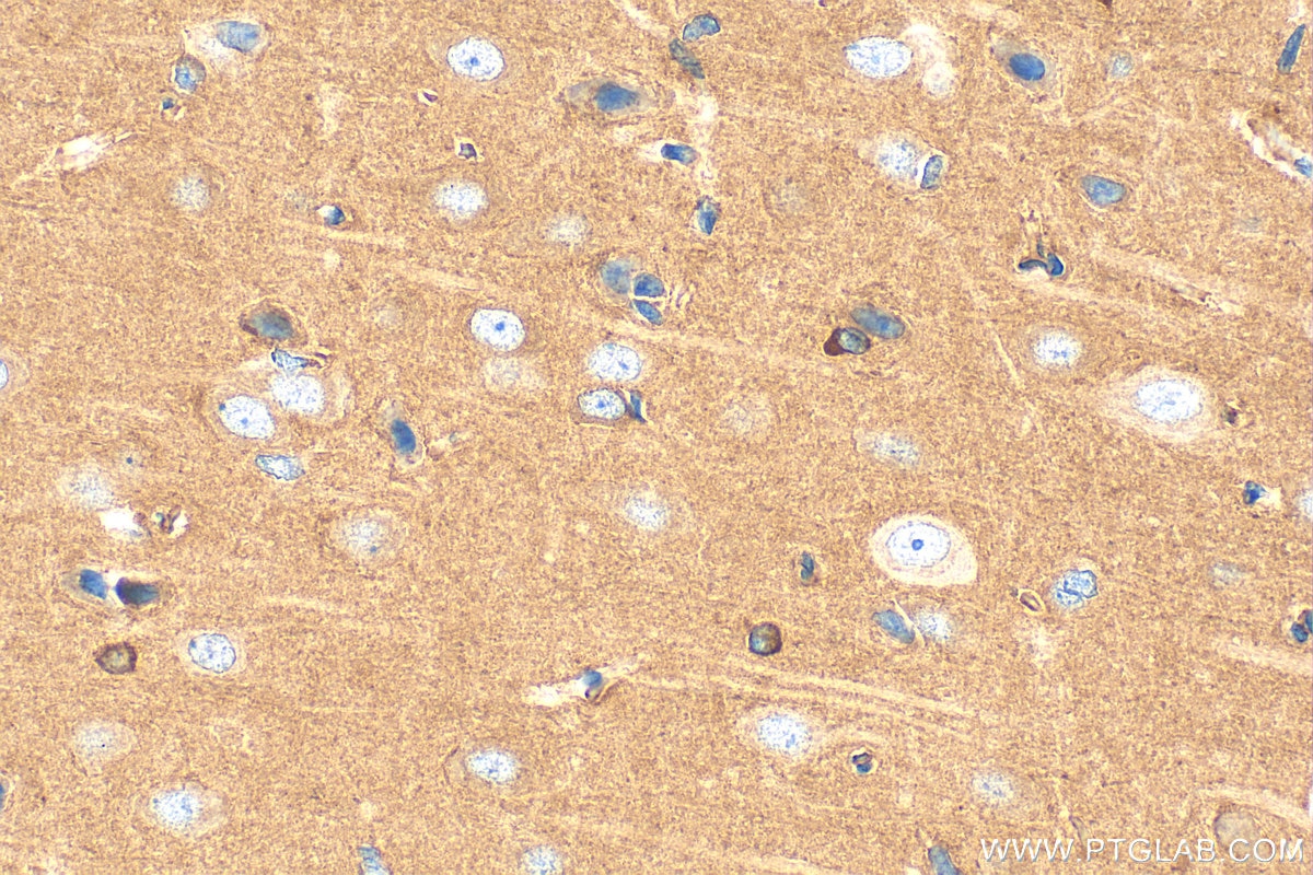 Immunohistochemistry (IHC) staining of rat brain tissue using PDE4B Polyclonal antibody (31730-1-AP)