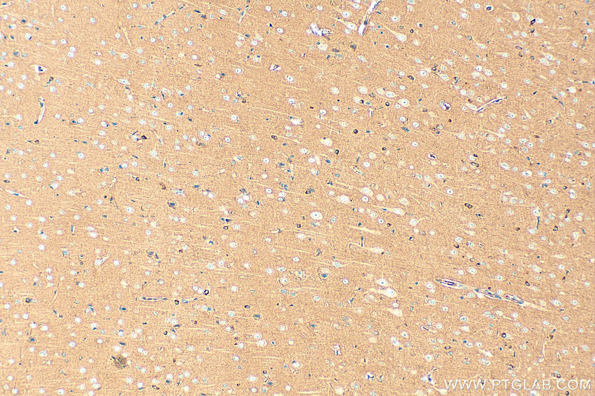 Immunohistochemistry (IHC) staining of rat brain tissue using PDE4B Polyclonal antibody (31730-1-AP)