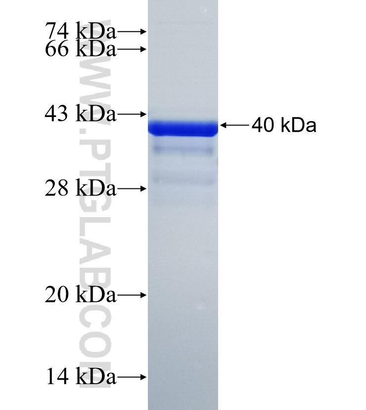 PDE4B fusion protein Ag35552 SDS-PAGE