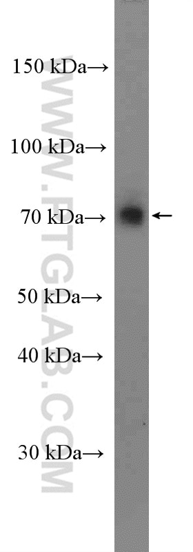 Western Blot (WB) analysis of mouse lung tissue using PDE4C Polyclonal antibody (21754-1-AP)