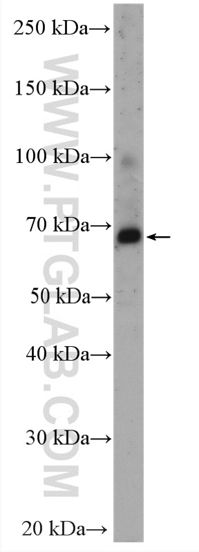 Western Blot (WB) analysis of HEK-293 cells using PDE4C Polyclonal antibody (21754-1-AP)