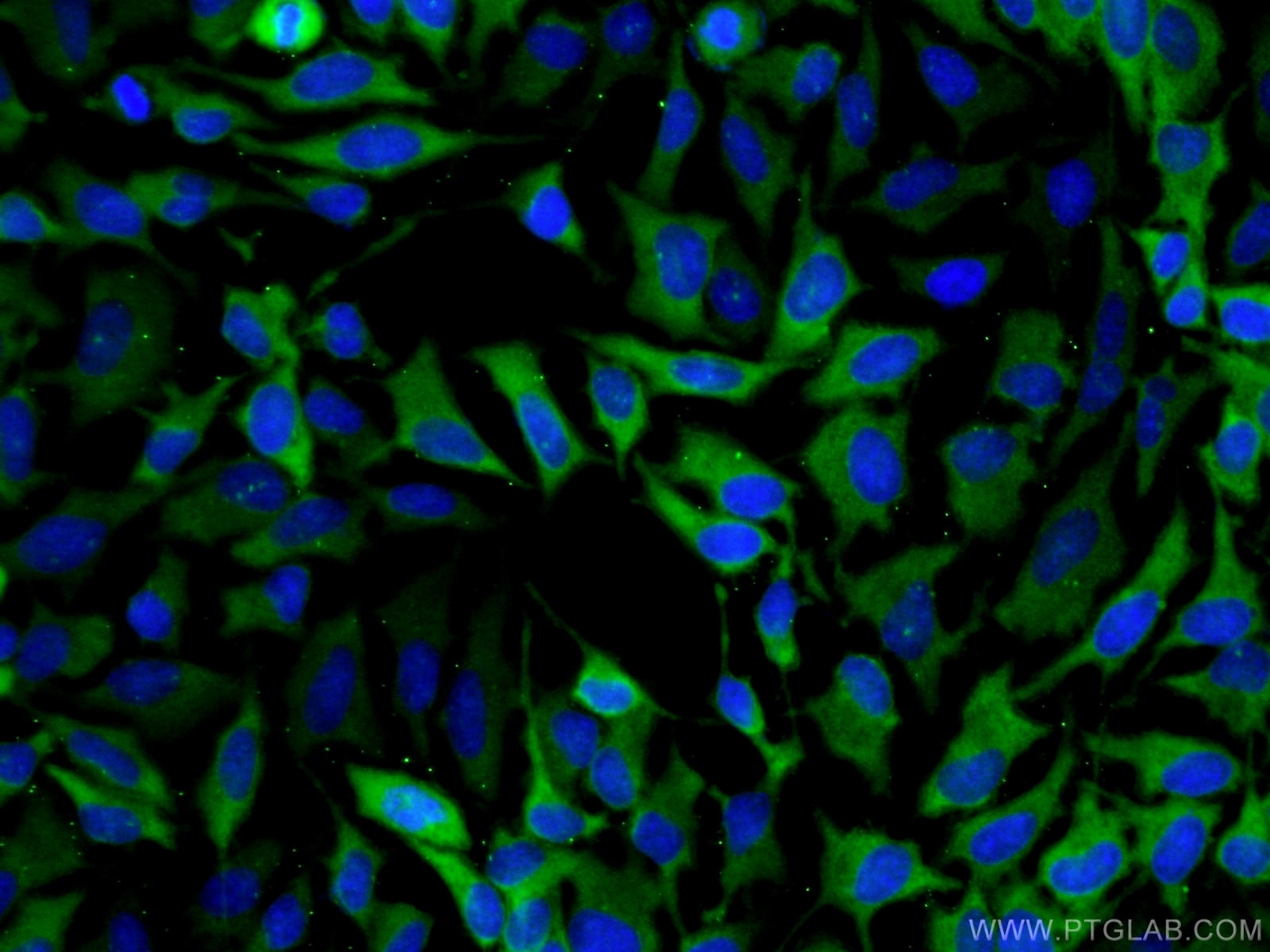 Immunofluorescence (IF) / fluorescent staining of HeLa cells using PDE4D Polyclonal antibody (12918-1-AP)