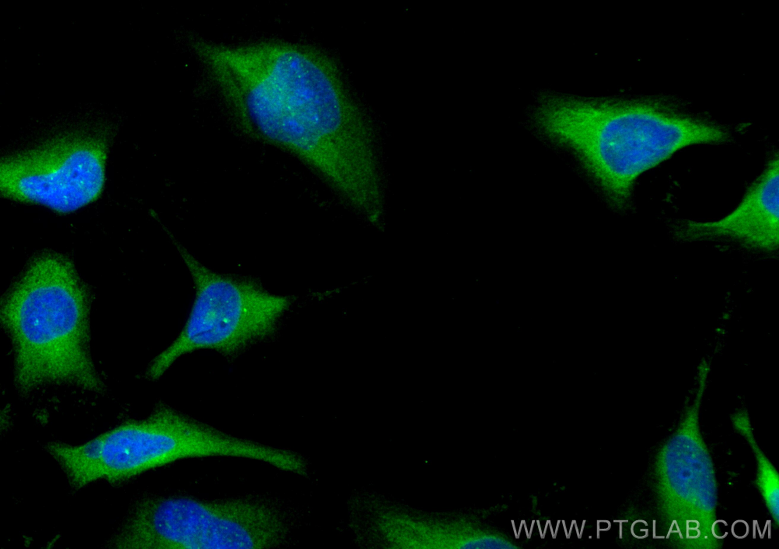 Immunofluorescence (IF) / fluorescent staining of HeLa cells using PDE4D Polyclonal antibody (12918-1-AP)