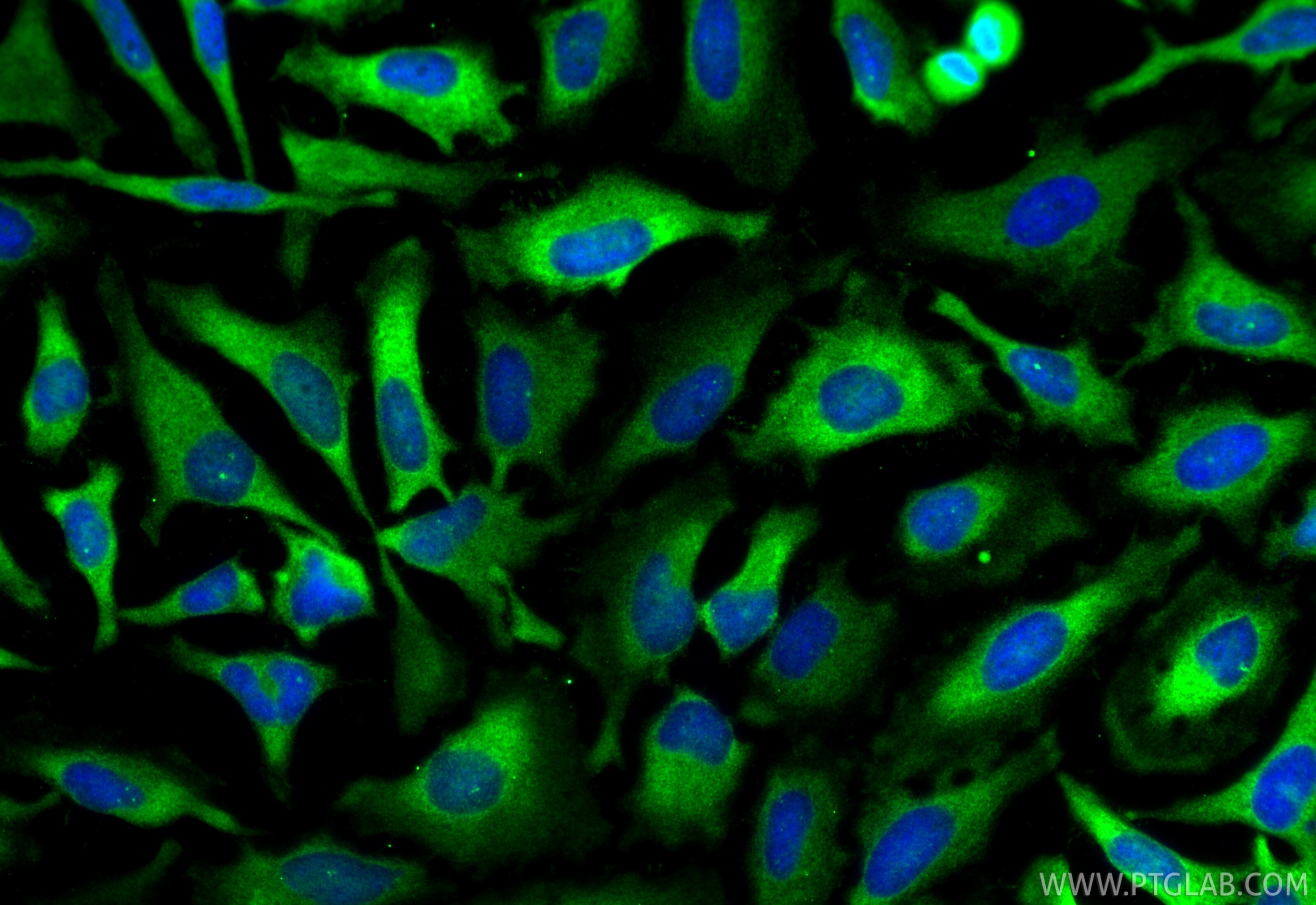 Immunofluorescence (IF) / fluorescent staining of HeLa cells using PDE4D Polyclonal antibody (12918-1-AP)