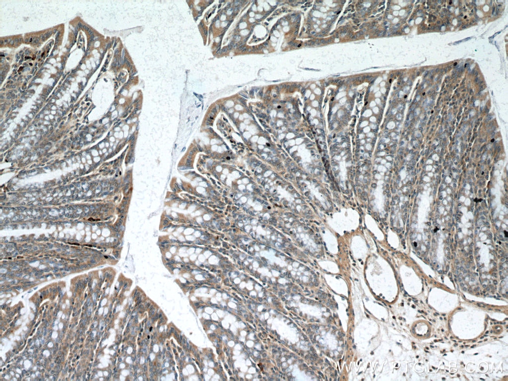 Immunohistochemistry (IHC) staining of mouse colon tissue using PDE4D Polyclonal antibody (12918-1-AP)