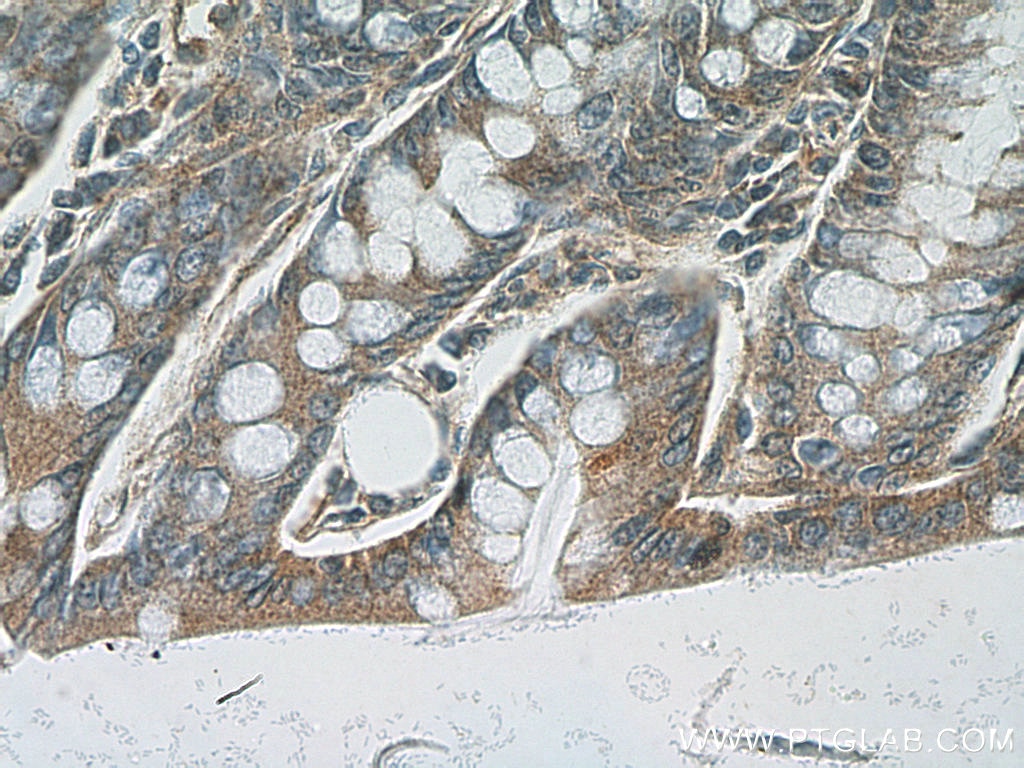 Immunohistochemistry (IHC) staining of mouse colon tissue using PDE4D Polyclonal antibody (12918-1-AP)