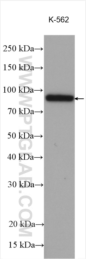 Western Blot (WB) analysis of various lysates using PDE4D Polyclonal antibody (12918-1-AP)