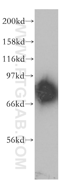 Western Blot (WB) analysis of mouse brain tissue using PDE4D Polyclonal antibody (12918-1-AP)